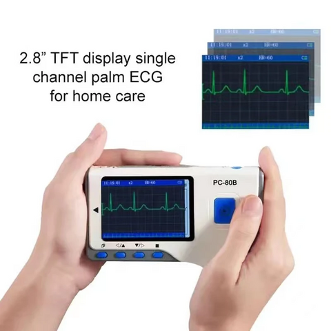 ECG Monitor for Home Care 2.8-inch TFT Display Multi-Site Monitoring