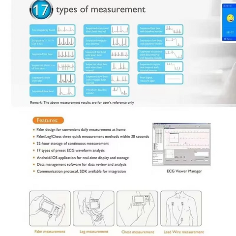 ECG Monitor for Home Care 2.8-inch TFT Display Multi-Site Monitoring